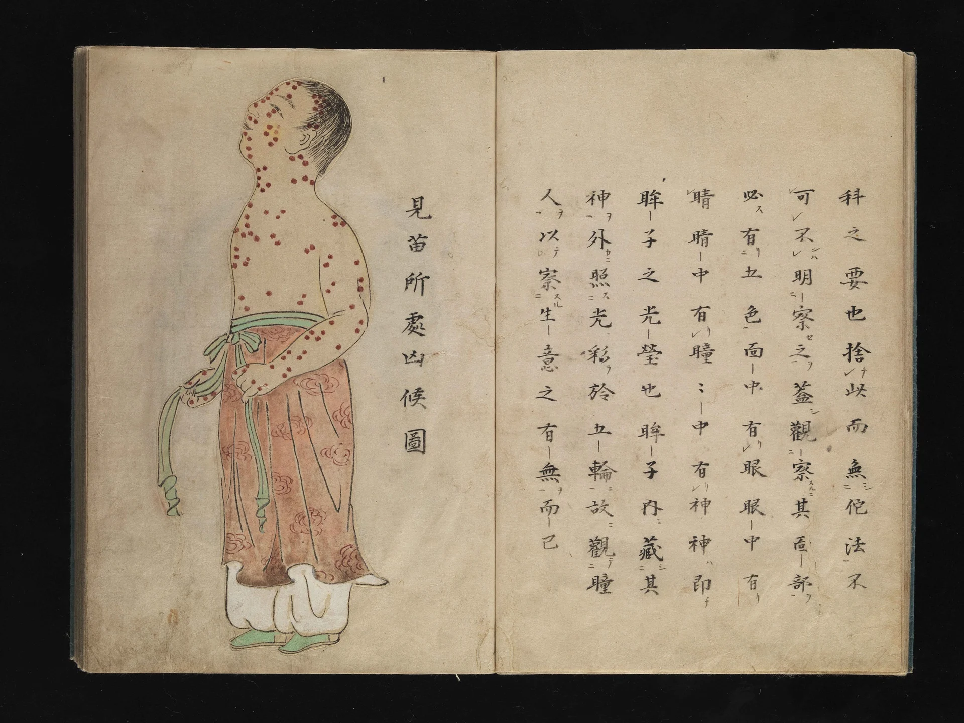 Ancient Japanese illustration of smallpox