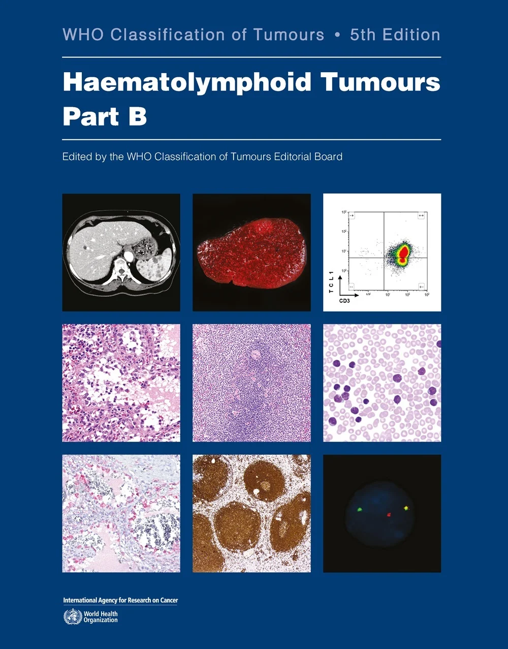 The WHO Classification of Tumours, Part B -thumbnail The WHO Classification of Tumours, Part B-thumbnail