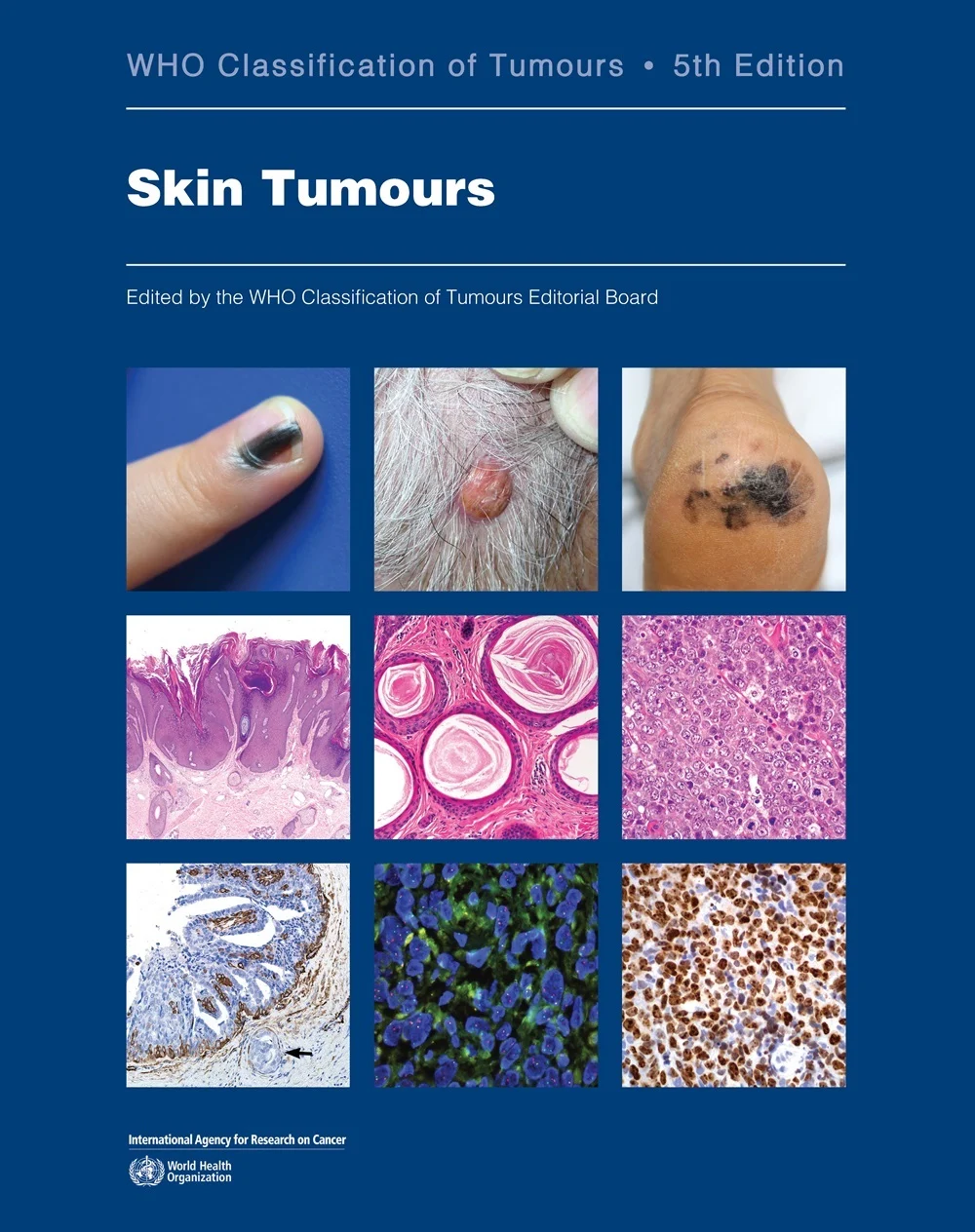 WHO Classification of Skin Tumours, 5th edition-thumbnail